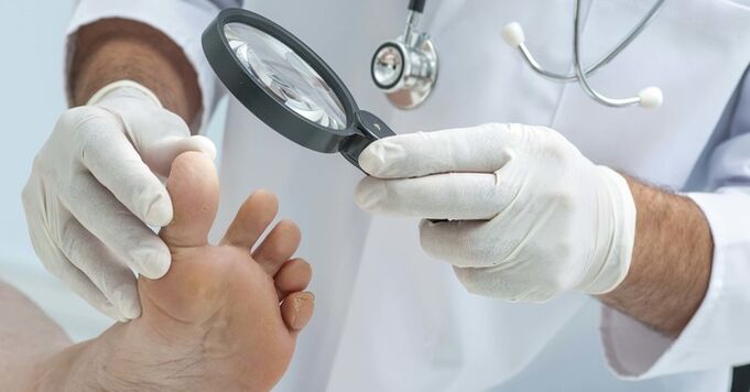 Exame diagnóstico das uñas dos pés