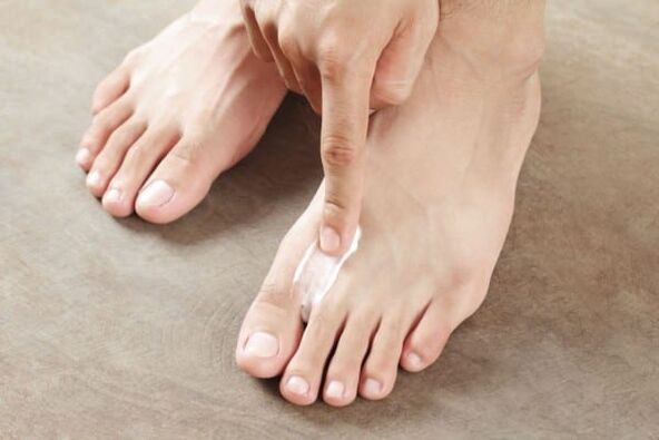 aplicación de pomada do fungo da pel nas pernas